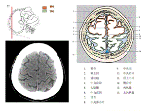 头颈CTMRI解剖图解第一季文档资料.ppt