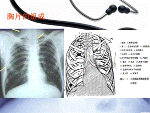 最新急危重病人床旁胸片的识别PPT文档.ppt