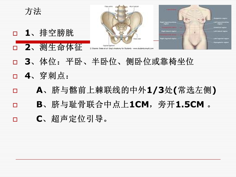 外科常用穿术课件PPT文档.ppt_第2页