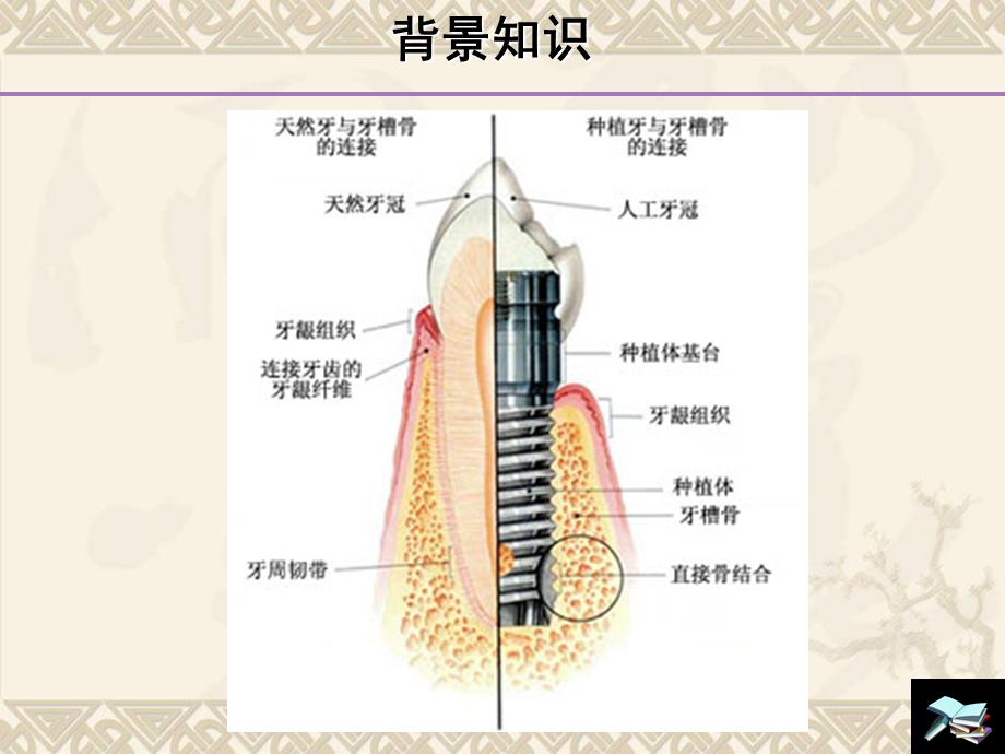 最新：牙种植体颈部骨吸收和平台转换技术研究进展文档资料.ppt_第3页