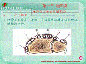 最新第十七章常见筋骨关节病PPT文档.ppt