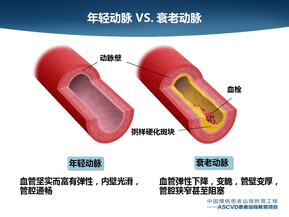 最新测测您的血管几岁了PPT文档.pptx_第3页