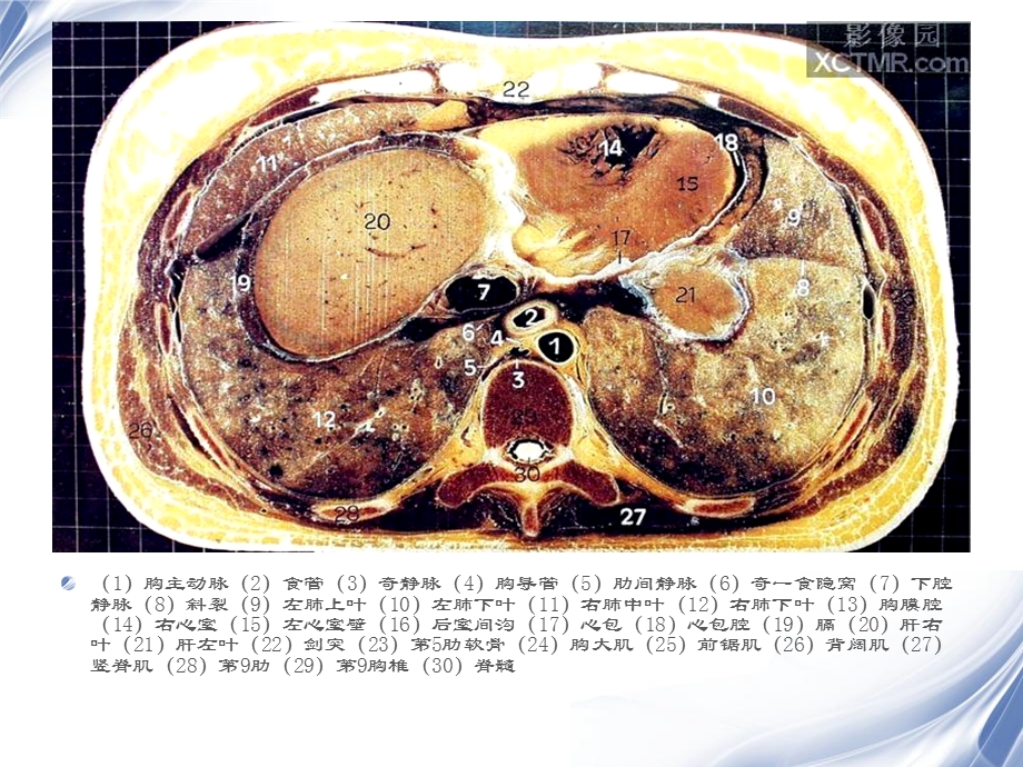 最新人体断层解剖图谱腹腔PPT文档.ppt_第2页