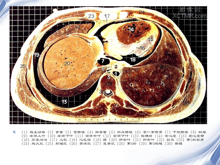 最新人体断层解剖图谱腹腔PPT文档.ppt_第3页