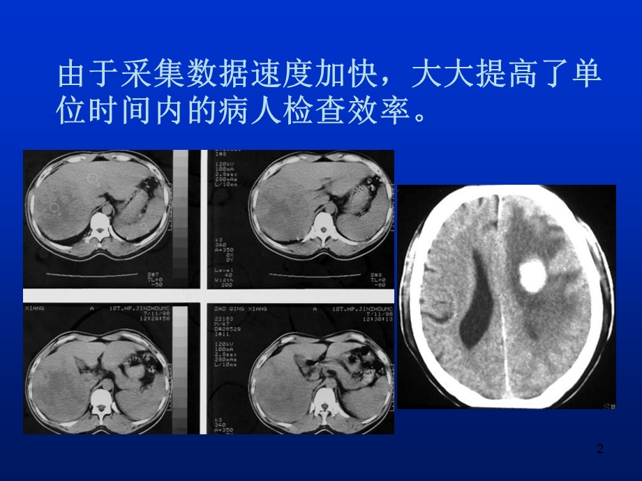 最新多层CT的临床应用PPT文档.ppt_第2页