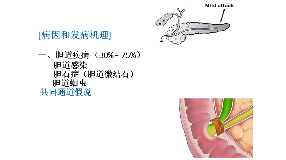 最新急性胰腺炎的药物治疗PPT文档.pptx_第3页