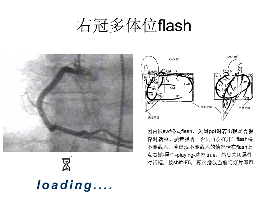 冠脉造影读片门新精选文档.ppt_第2页