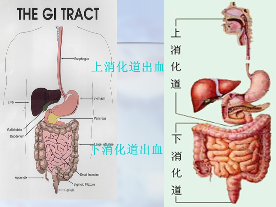 最新：(内科护理学)第十二节上消化道大出血文档资料.ppt_第1页