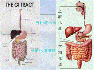 最新：(内科护理学)第十二节上消化道大出血文档资料.ppt