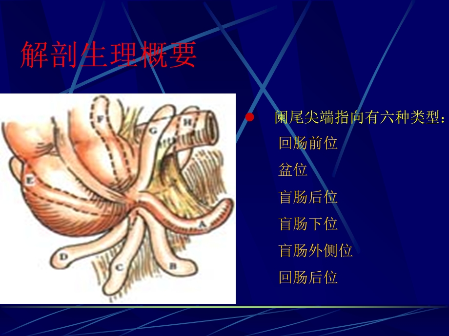 最新阑尾炎分析课件PPT文档.ppt_第2页