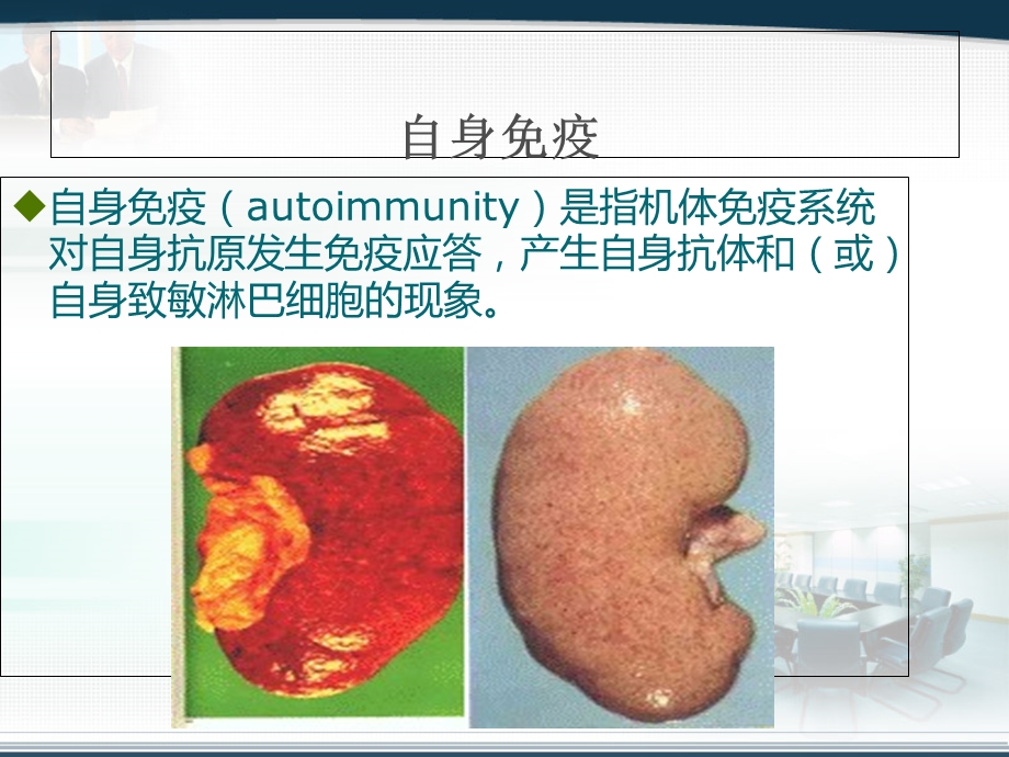 肺出血与肾炎综合征文档资料.ppt_第1页