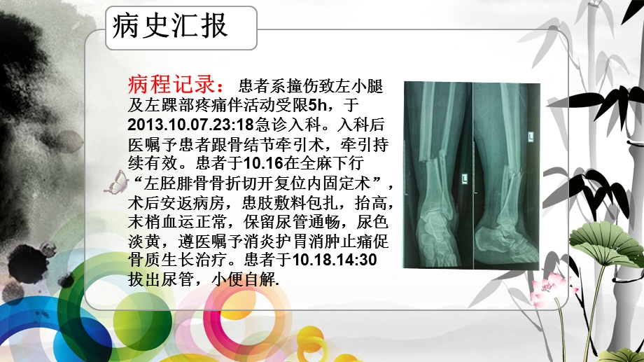 左胫腓骨骨折护理查房lppt课件PPT文档.ppt_第3页