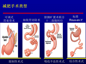 最新：减肥手术后内分泌代谢紊乱及预防文档资料.ppt