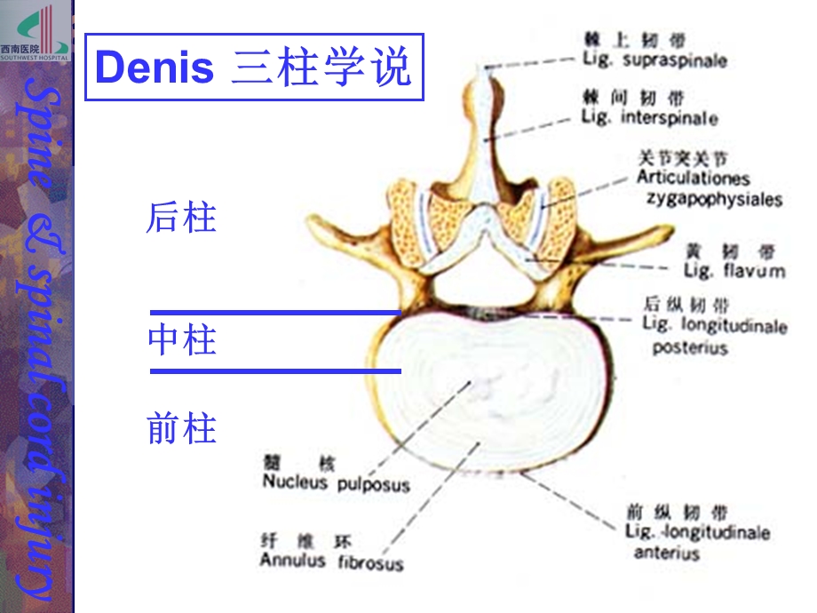 本科6版脊柱和脊髓损伤文档资料.ppt_第3页