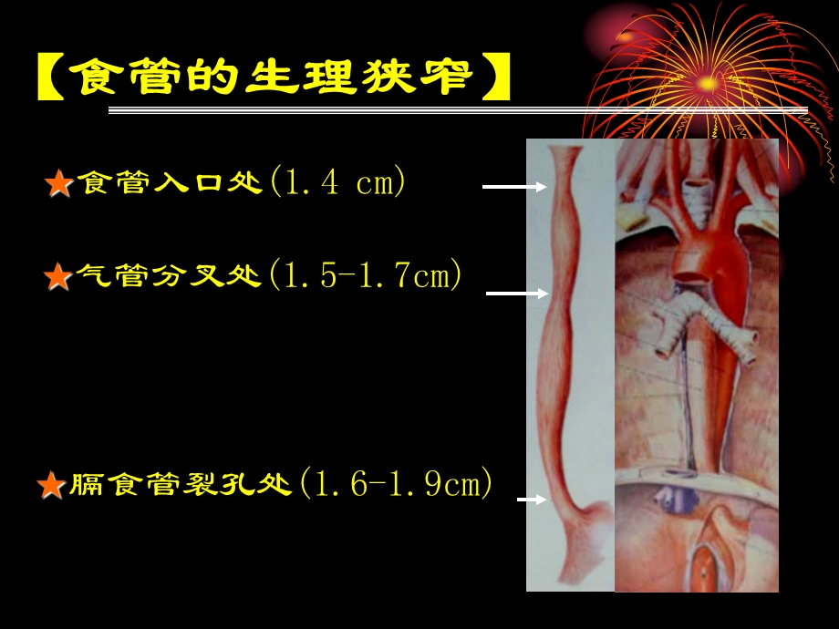 外科护理学第15章第4节食道癌文档资料.ppt_第2页