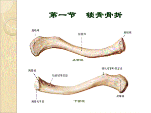 最新哈尔滨科大学肿瘤外科学上肢骨关节损伤PPT文档.ppt