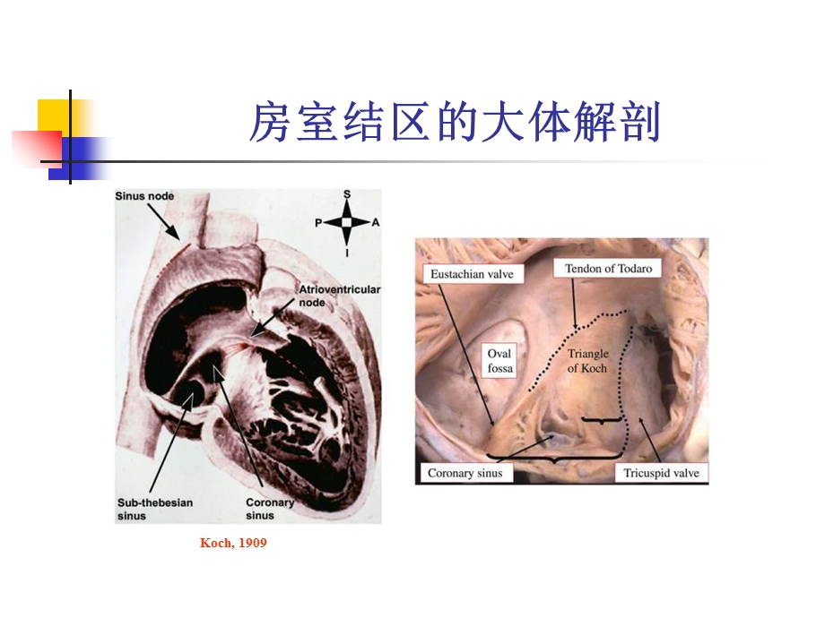 房室结双径路传导的基本电生理特征与常见心电图表现分析单兆亮PPT文档.ppt_第1页