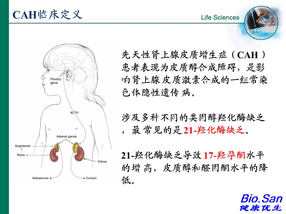 新生儿疾病筛查皮质肾上腺PPT文档资料.ppt_第1页