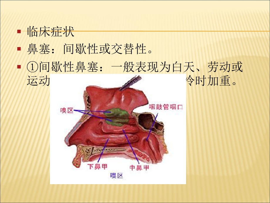 五官科精选文档.ppt_第2页