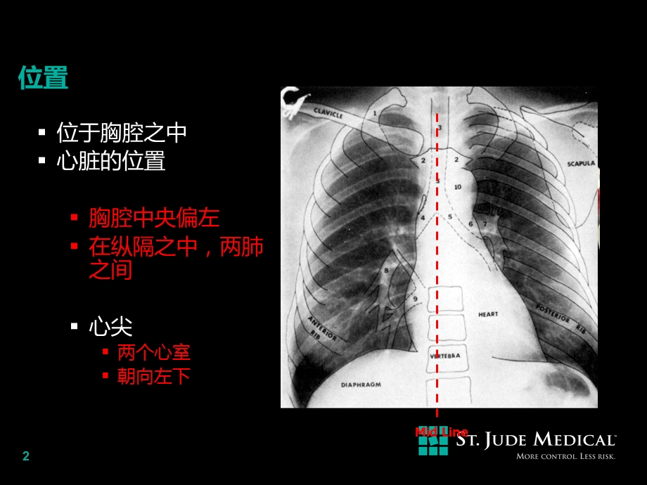 心脏解剖及传导精选文档.ppt_第2页