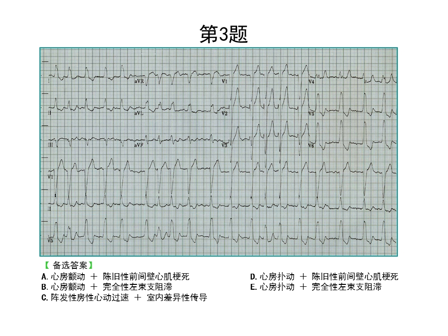 最新：心电图考核题文档资料.ppt_第2页