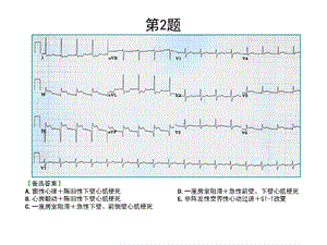 最新：心电图考核题文档资料.ppt