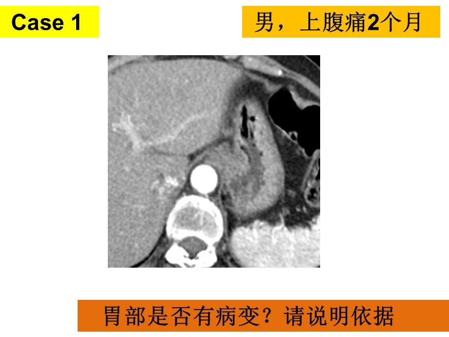 影像规培生胃肠道测试解析ppt课件精选文档.ppt_第3页