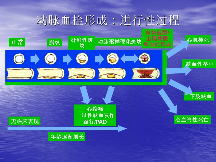 急性冠脉综合征抗栓及溶栓文档资料.ppt_第3页