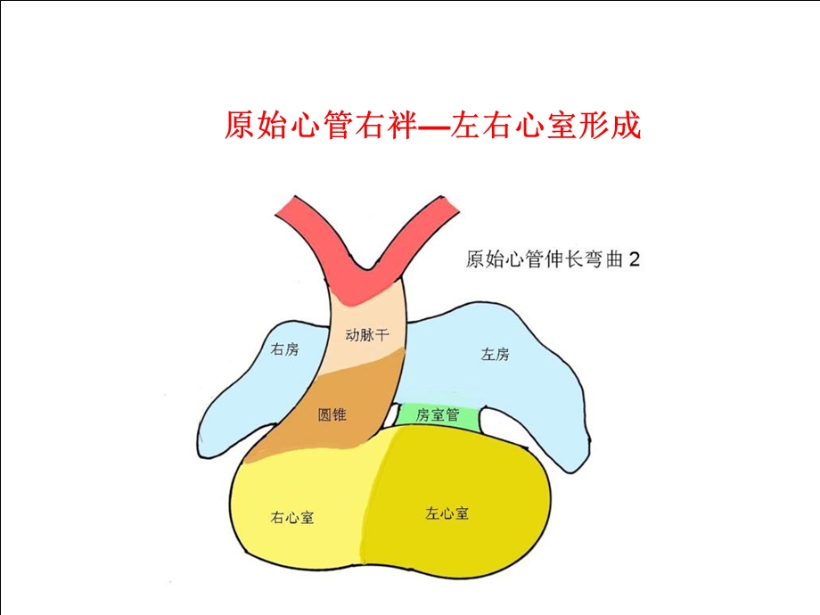 VSD外科解剖朱晓东院士PPT课件.ppt_第3页