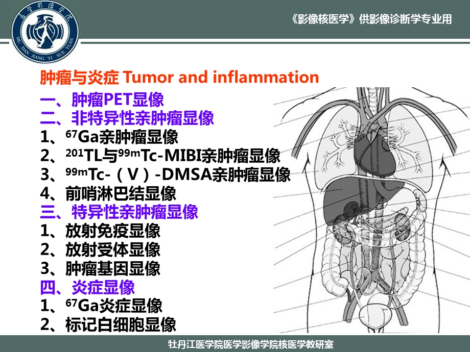 最新：肿瘤与炎症系统的案例课件 .10文档资料.ppt_第2页