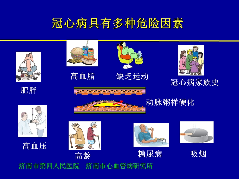 最新二型心电图计分系统对诊断冠脉多支病变意义的新评价贾如意ppt课件PPT文档.ppt_第2页