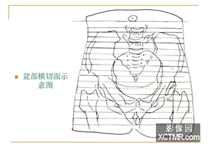 人体断层解剖图谱盆腔文档资料.ppt