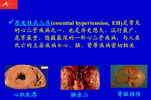 原发性高血压研究的新进展线粒体基因突变在原发性高血压PPT课件.ppt