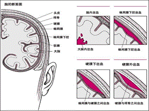 最新神经外科常见引流管的护理PPT文档.ppt