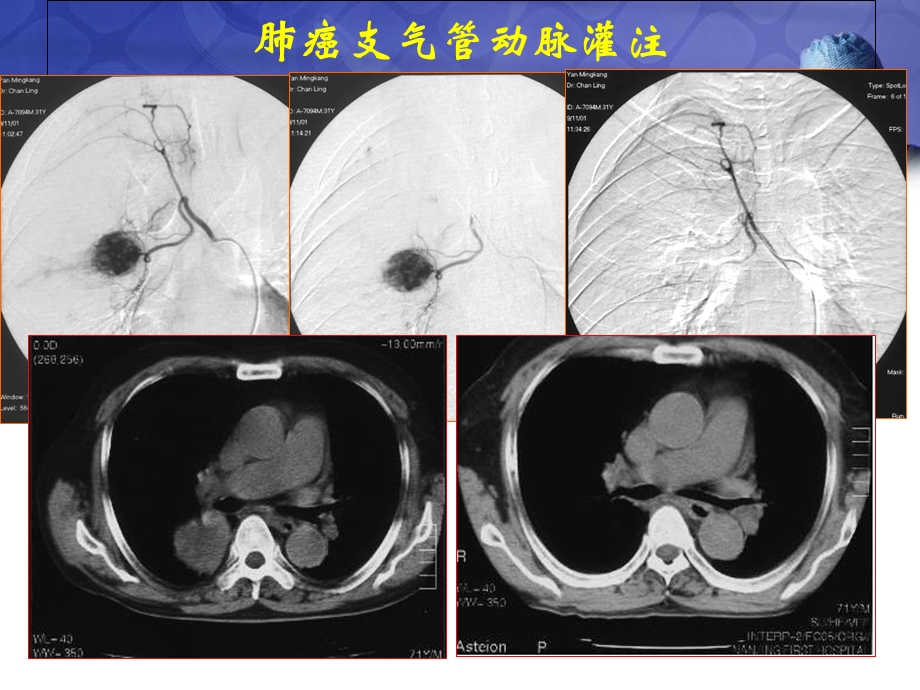 最新：血管介入科门诊ppt课件文档资料.ppt_第3页