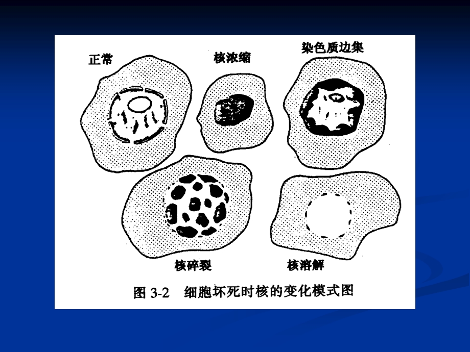 不可逆性损伤PPT课件.ppt_第3页