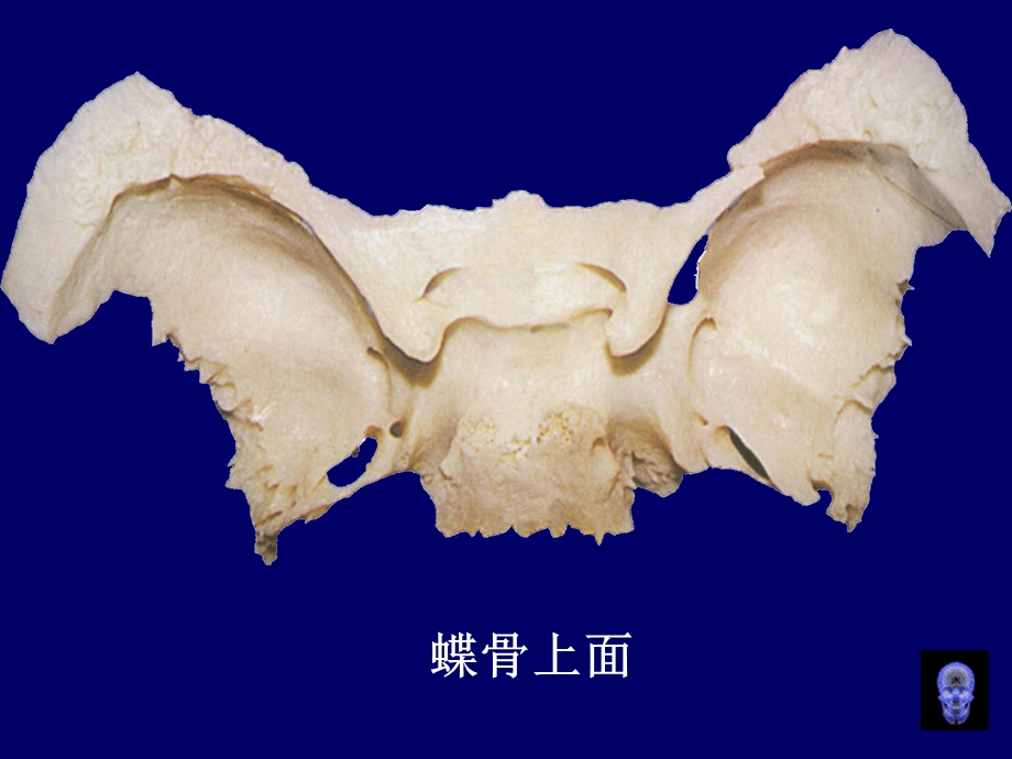 最新鞍区与脑桥小脑三角区显微解剖PPT文档.ppt_第2页