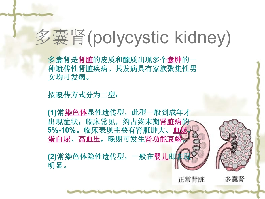 最新多囊肾的护理PPT文档.ppt_第1页