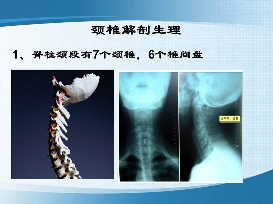 哈尔滨医科大学肿瘤外科颈椎病PPT文档资料.ppt_第2页