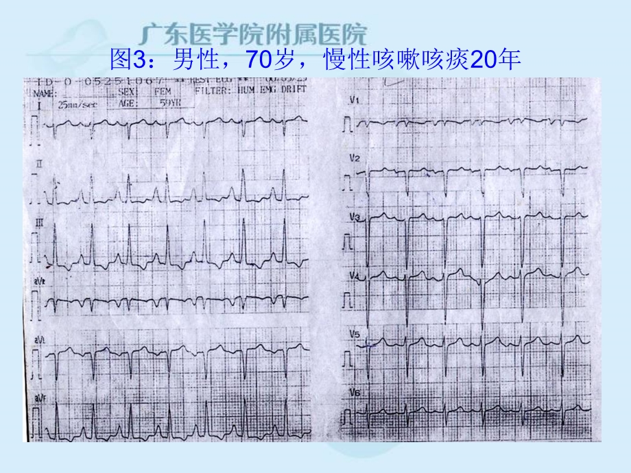 最新：异常心电图见习课文档资料.ppt_第2页