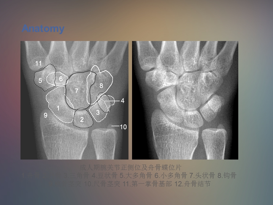 最新：腕关节x线解剖测量分析文档资料.ppt_第2页