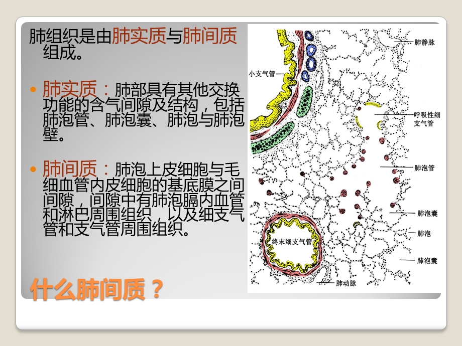 弥漫性间质性肺病护理查房文档资料.pptx_第2页