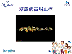 糖尿病高脂血症文档资料.ppt