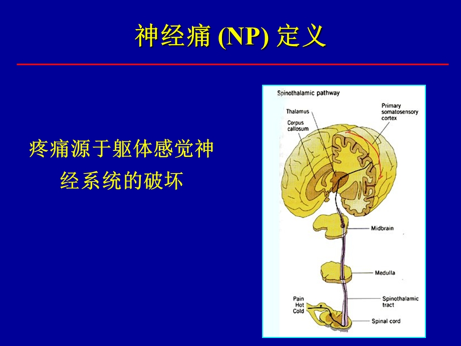 神经痛与阿片类药物文档资料.ppt_第1页