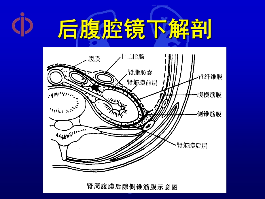 最新后腹腔镜肾上腺手术探讨PPT文档.ppt_第3页