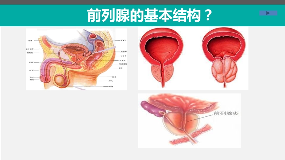 前列腺增生标准课件课件文档资料.ppt_第2页