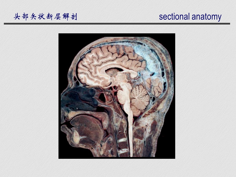 头部矢状断层解剖文档资料.ppt_第3页