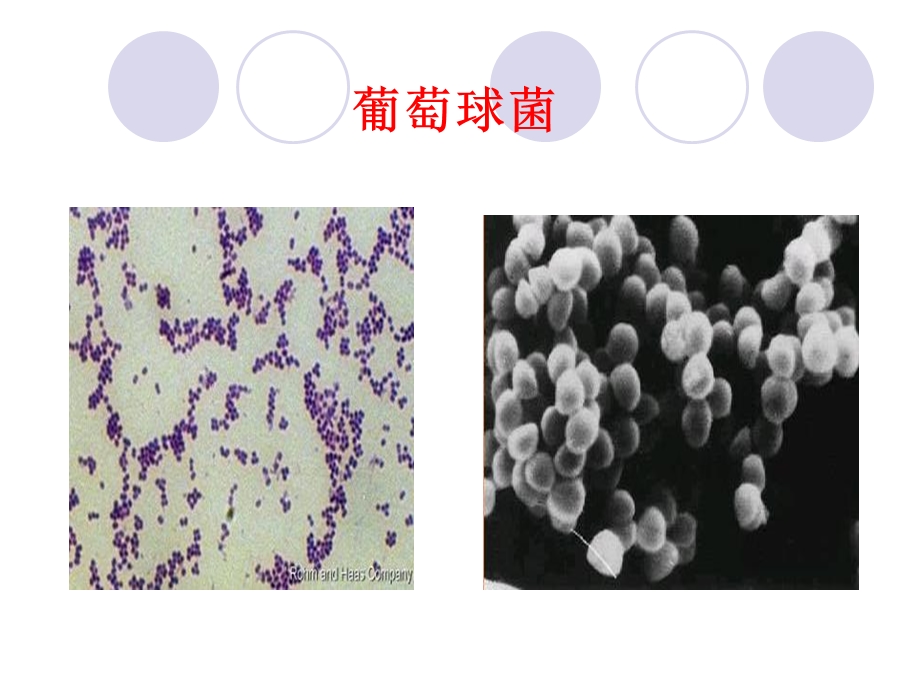 6细菌、病毒各论PPT文档.ppt_第2页