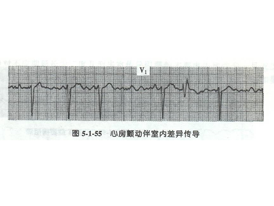 最新：诊断学课件心图3文档资料.ppt_第1页