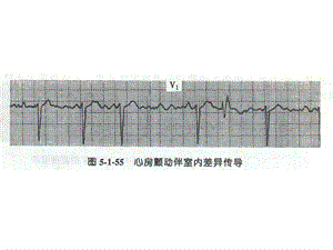 最新：诊断学课件心图3文档资料.ppt